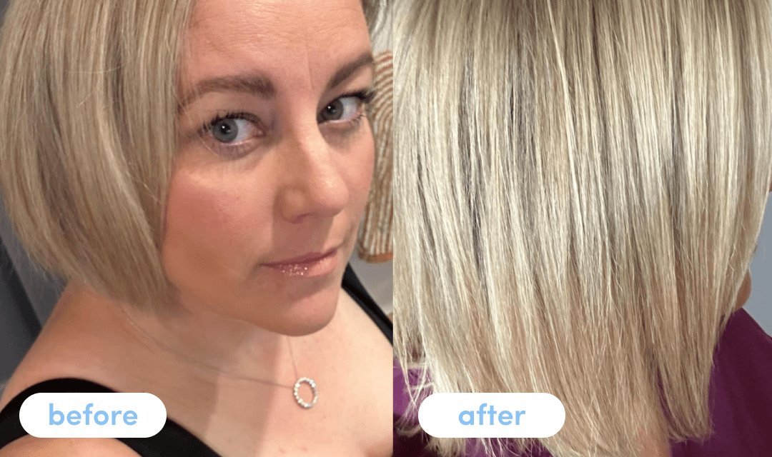 Aimee has been taking Premium Collagen for 3 months