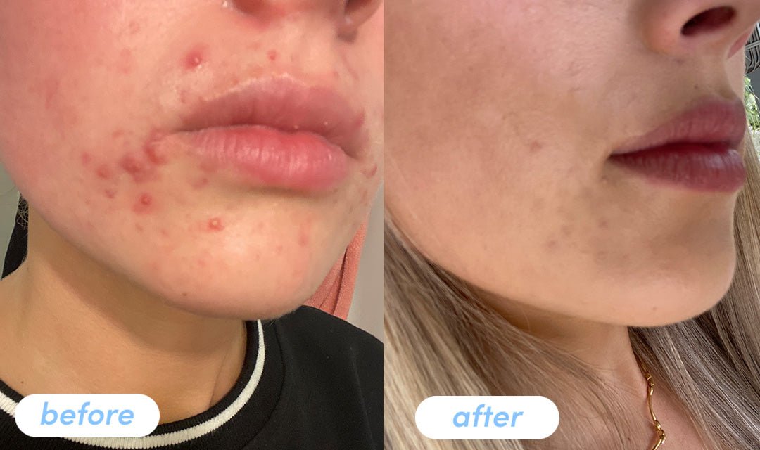 Bella M. - Taking Premium Collagen Peptides for 6 weeks