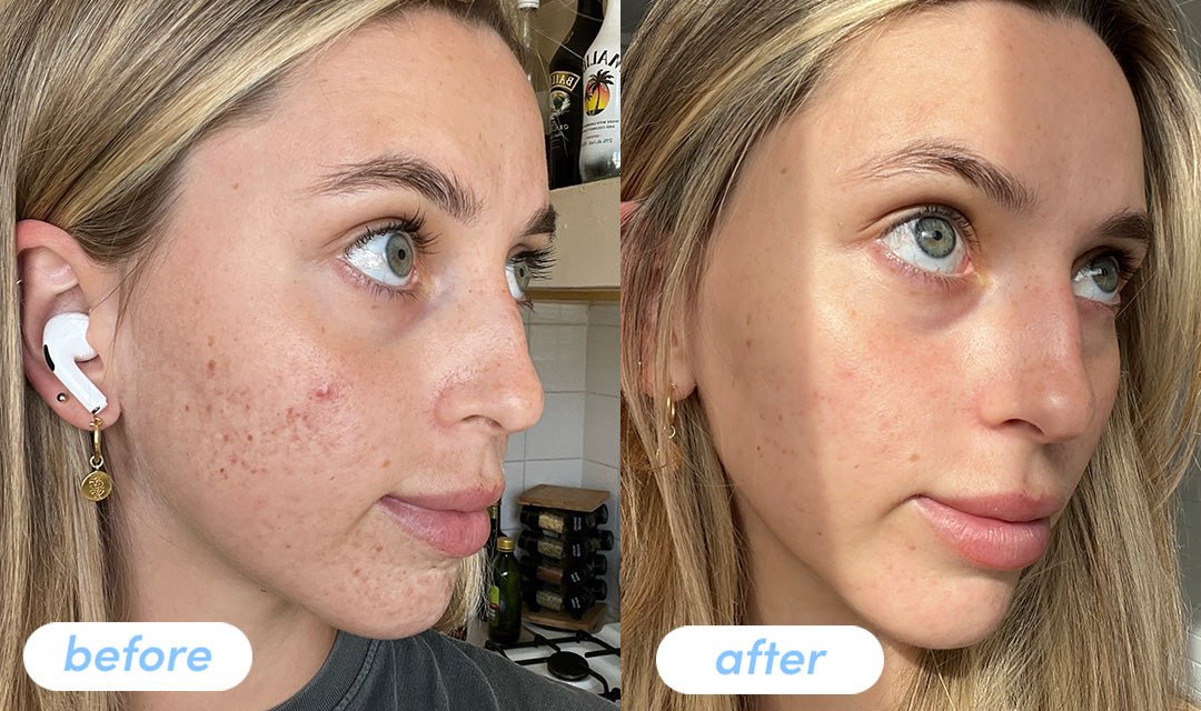 Bonnie K. - Taking Premium Collagen Peptides for 8 weeks