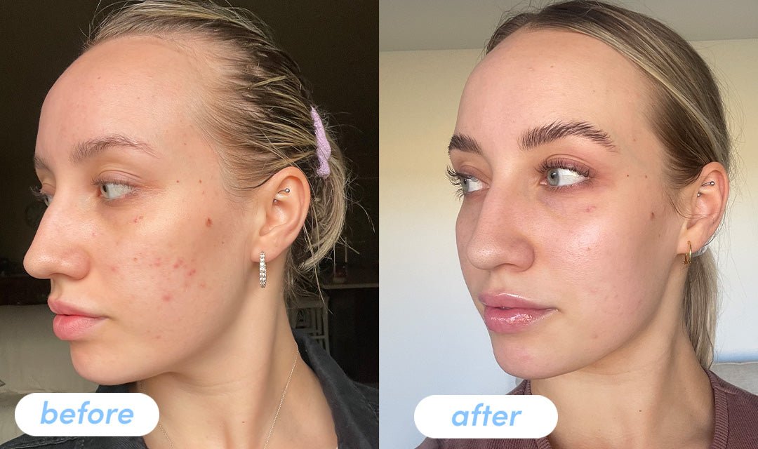 Chloe B. - Taking Premium Collagen Peptides For 6 weeks