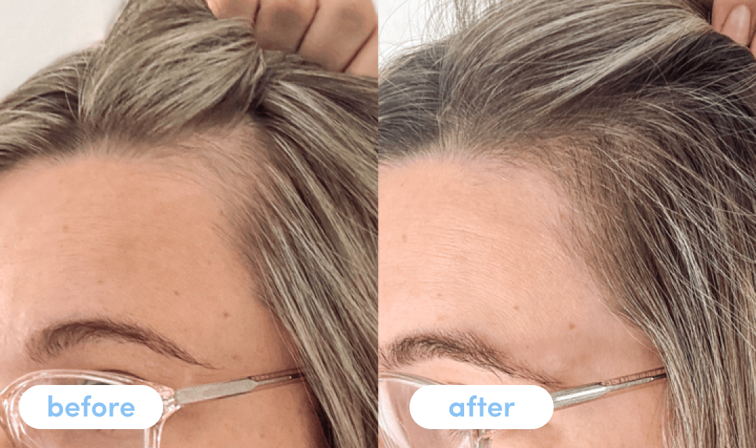 Emma S. - Taking Premium Collagen Peptides for 6 weeks