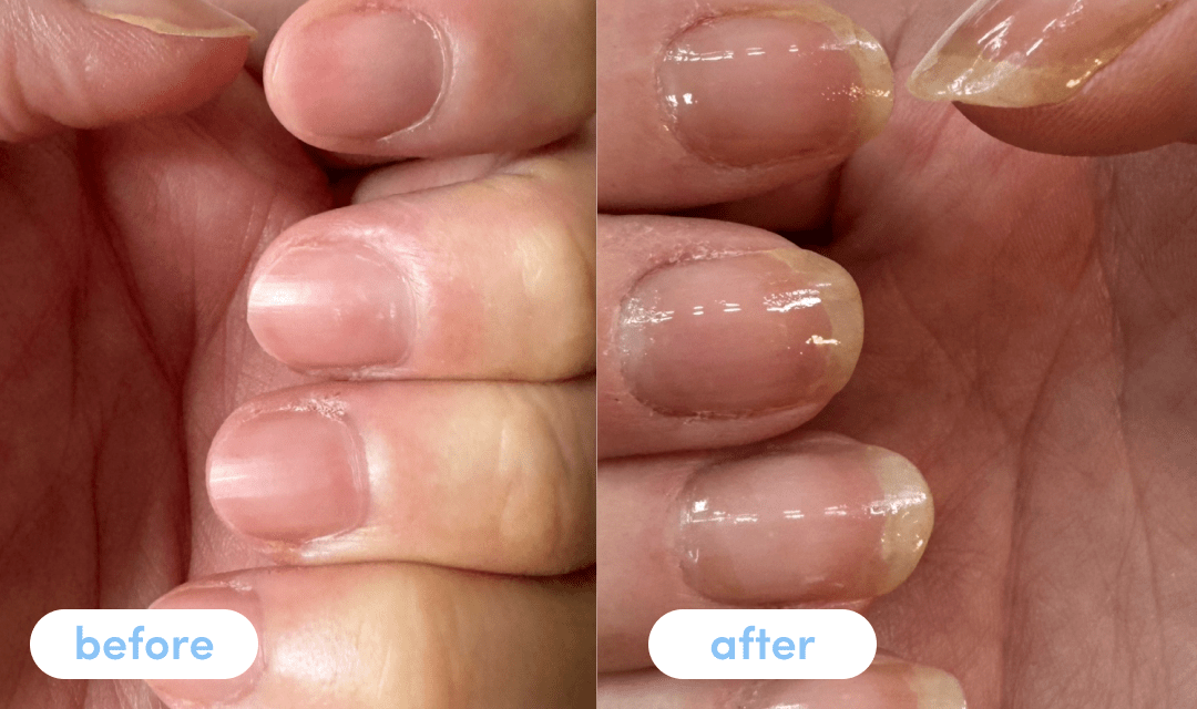 Hayley S. - Taking Premium Collagen Peptides for 4 weeks