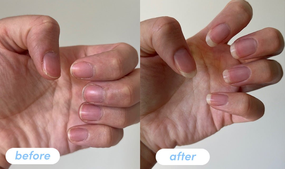 Hayley S. - Taking Premium Collagen Peptides for 6 weeks