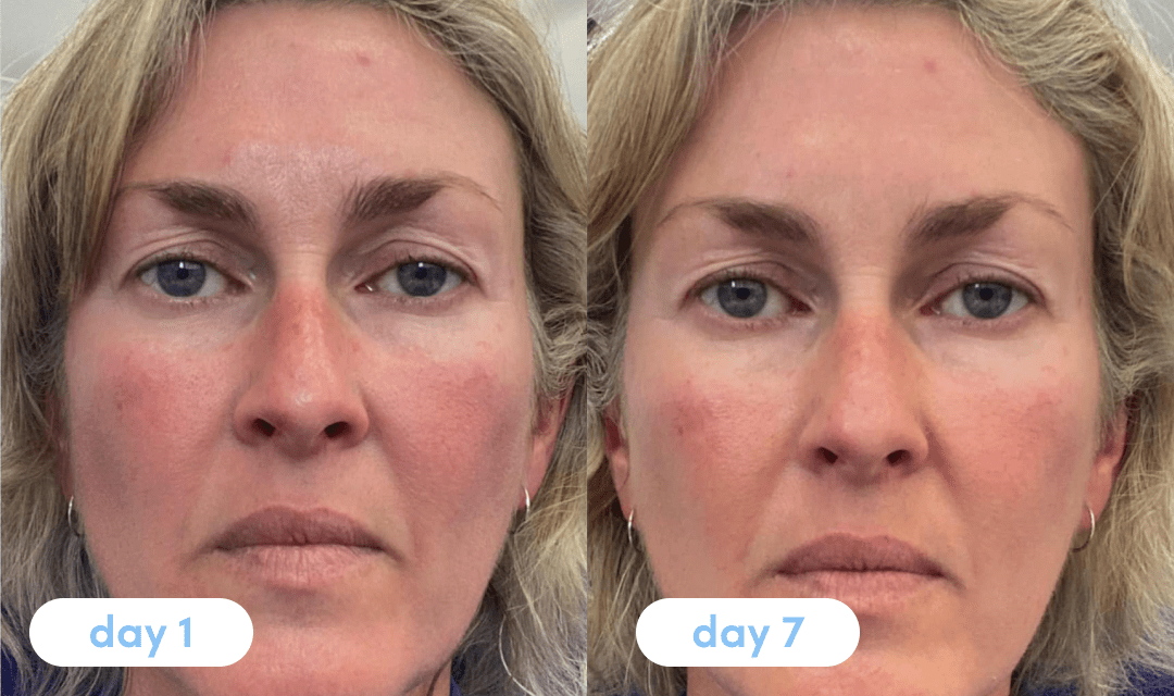 Heidi M. has been taking Premium Collagen for 7 days