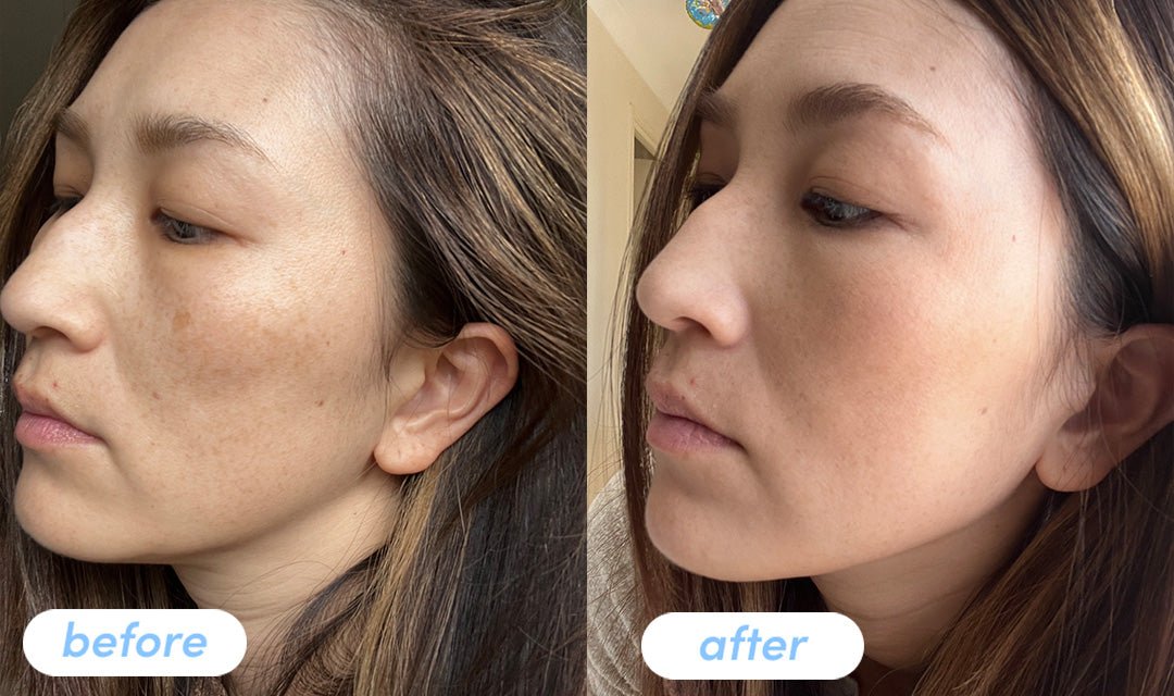 Hiromi - Taking Premium Collagen Peptides for 4 weeks