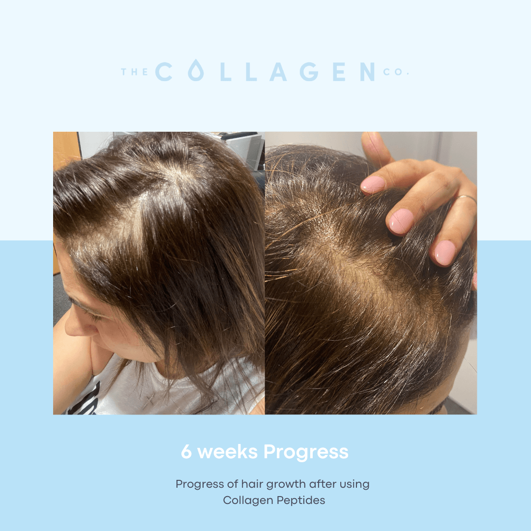 How Jeanette recovered from Postpartum and Virus-related hair loss