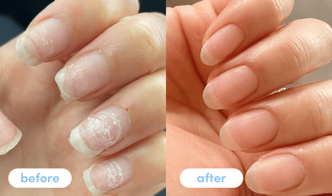 Jacqueline D. - Taking Premium Collagen Peptides for 4 weeks