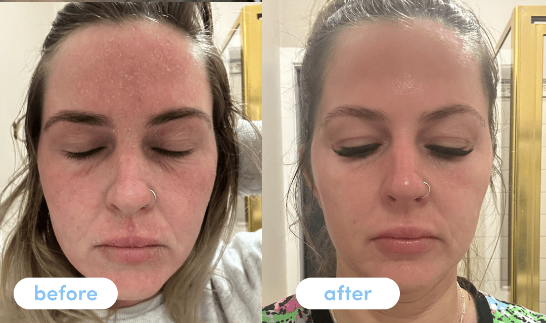 Jasmine H. has been taking Premium Collagen Peptides for 12 weeks