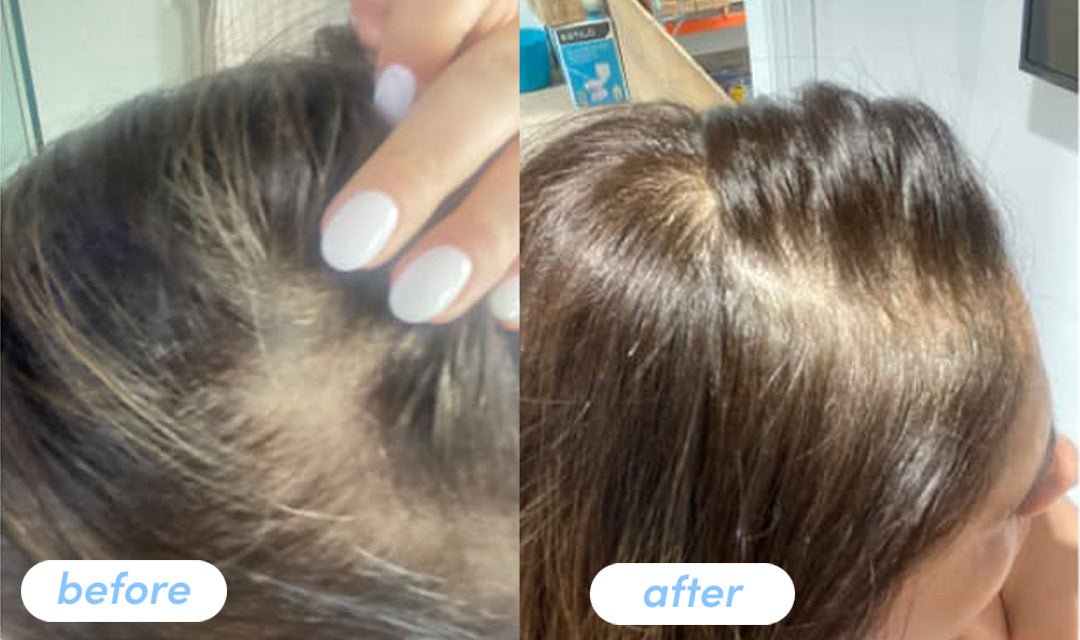 Jeanette M. - Taking Premium Collagen Peptides for 5 months