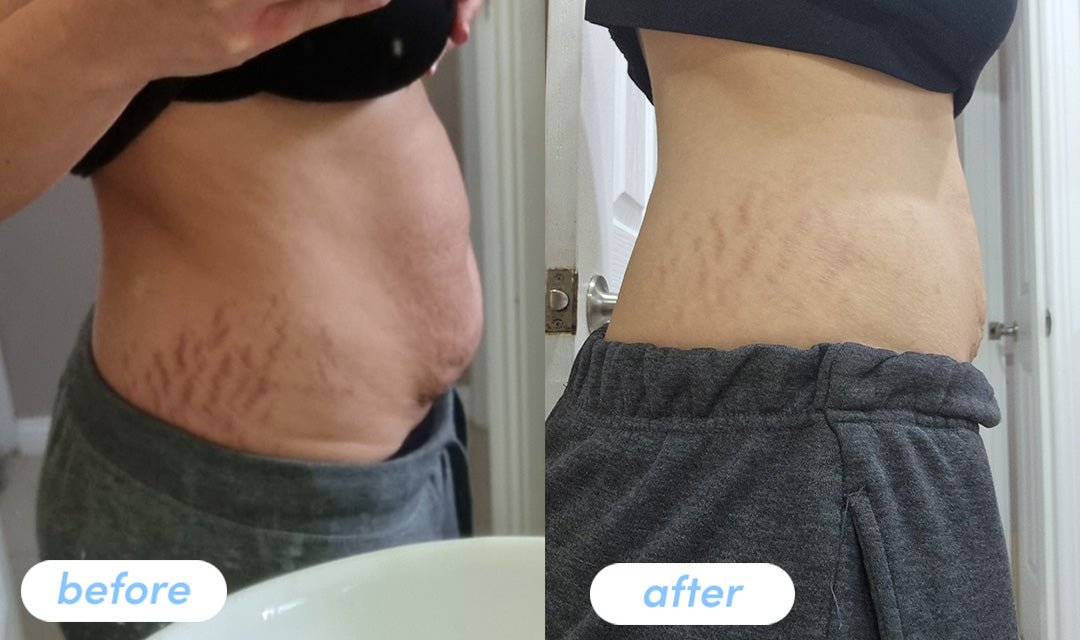 Jessica V. - Taking Premium Collagen Peptides for 6 weeks