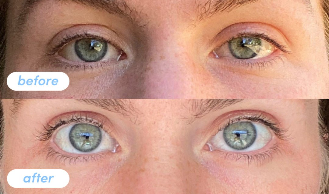 Lauren D. - Taking Premium Collagen Peptides for 6 weeks