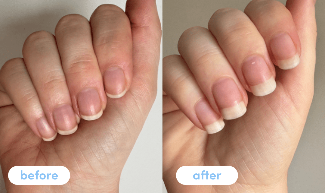 Nare P. - Taking Premium Collagen Peptides for 4 weeks