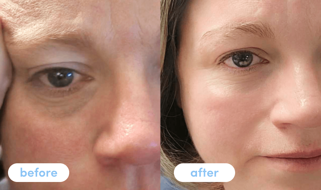 Rebecca D. - Taking Premium Collagen Peptides for 4 weeks