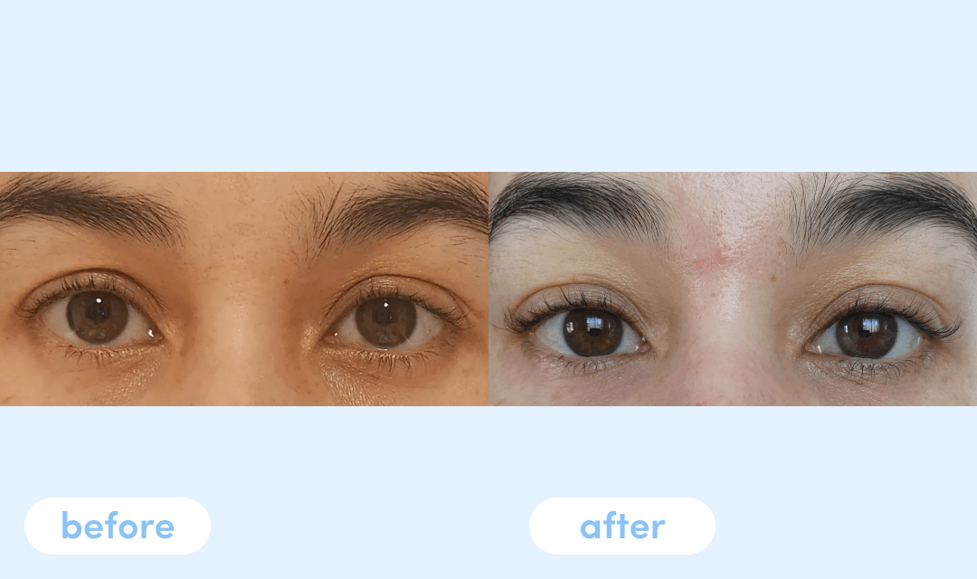 Sarah B. Has Been Taking Premium Collagen for 4 Weeks