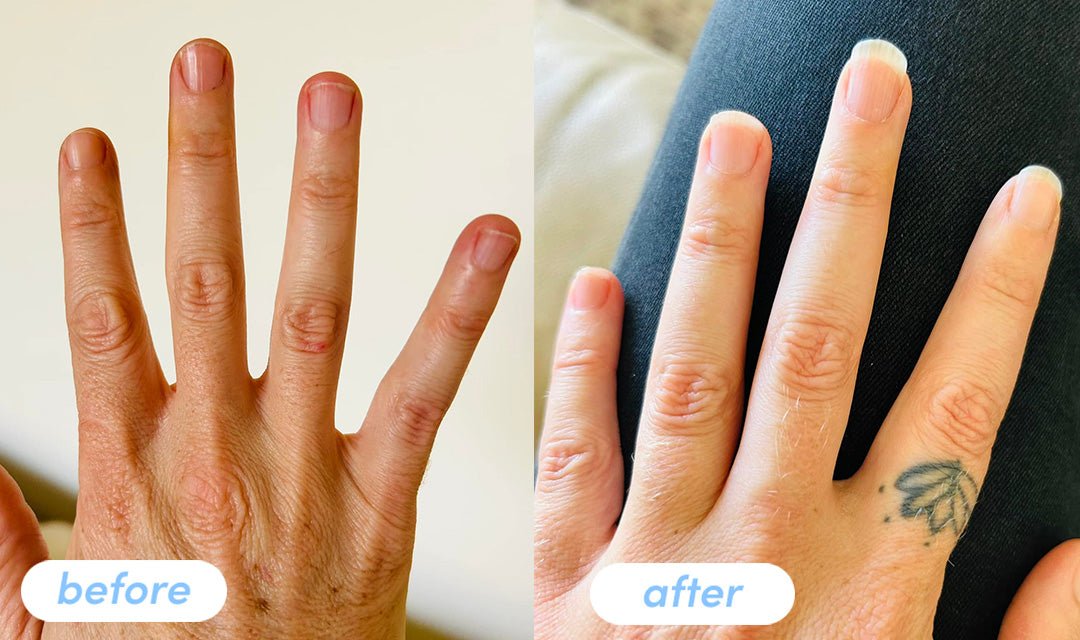 Sarah P. - Taking Premium Collagen Peptides for 4 weeks