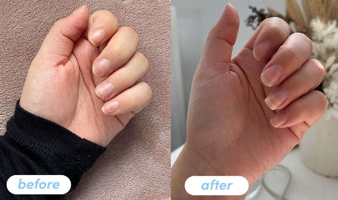 Stephanie H. - Taking Premium Collagen Peptides for 6 weeks