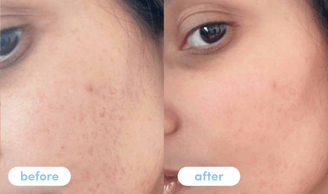 Surabhi R. - Taking Premium Collagen Peptides for 4 weeks