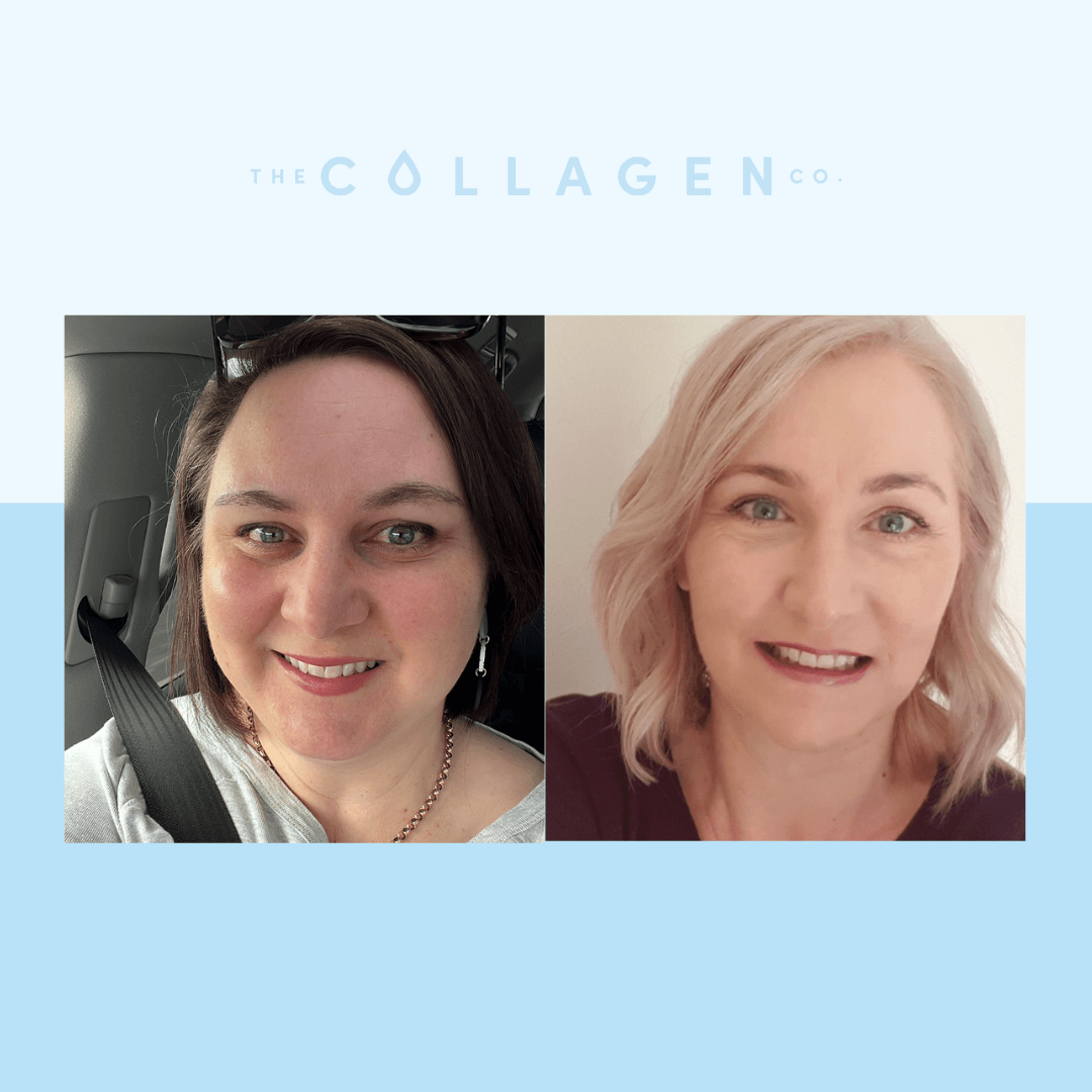 Two Mums On How Collagen Helps Their Skin and Gut Health