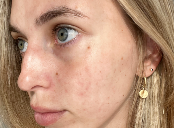 Close-up of a woman's face showing natural skin texture and light freckles. She has light hair and wears a small gold earring.