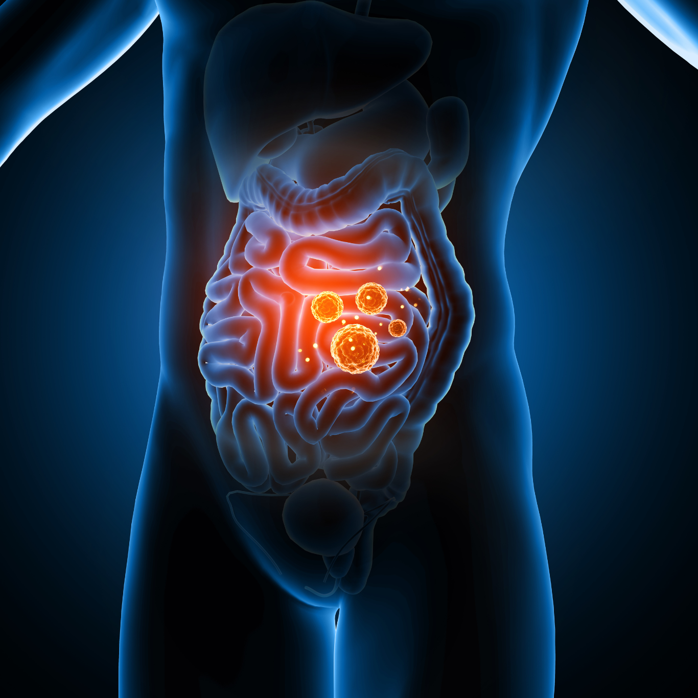 X-ray image of human torso showing glowing orange gut bacteria in stomach and intestines, symbolizing digestive health and microbiome balance.