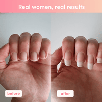 Before and after comparison showing nail growth results from Mixed Flavours Collagen Sachets usage