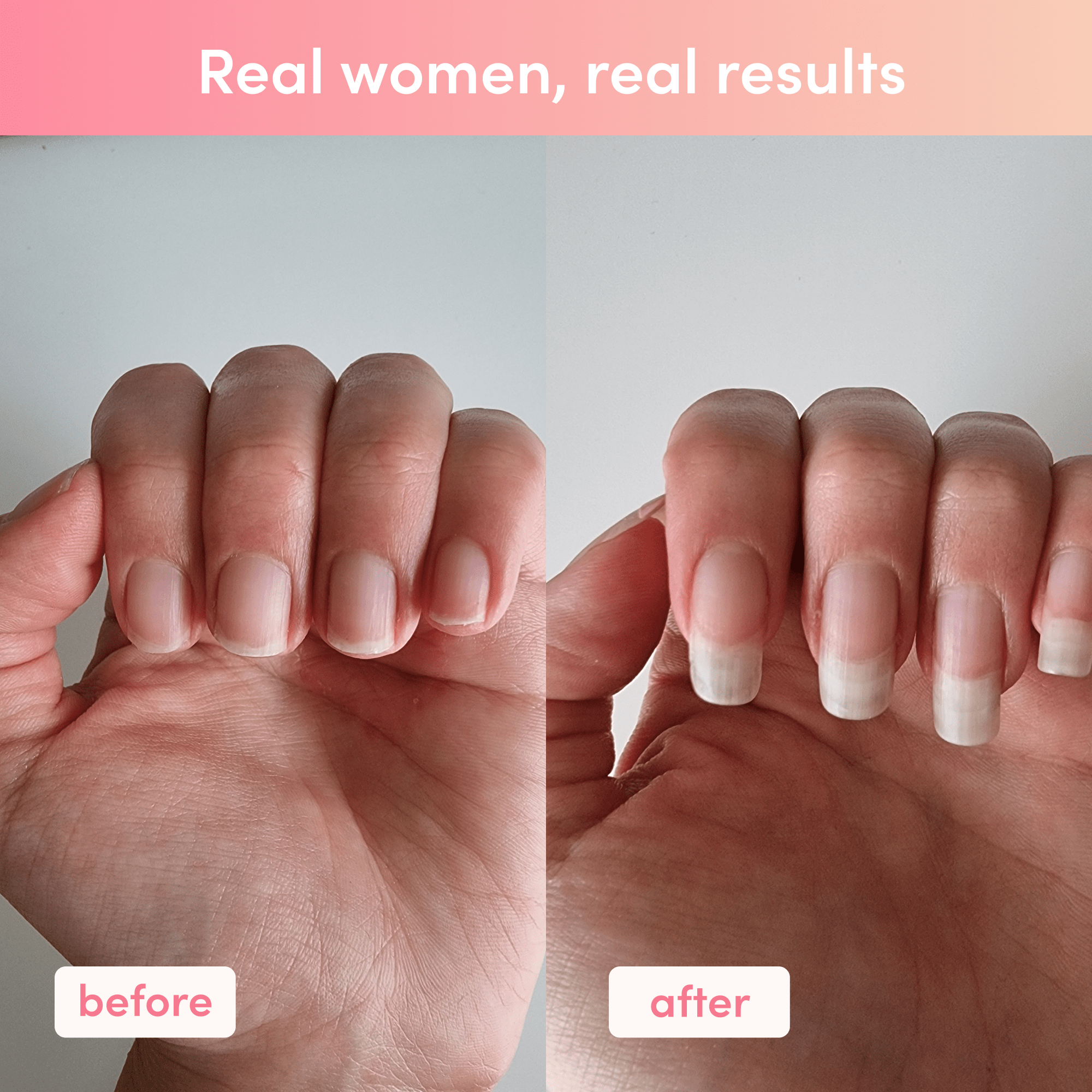 Before and after comparison showing nail growth results from Mixed Flavours Collagen Sachets usage