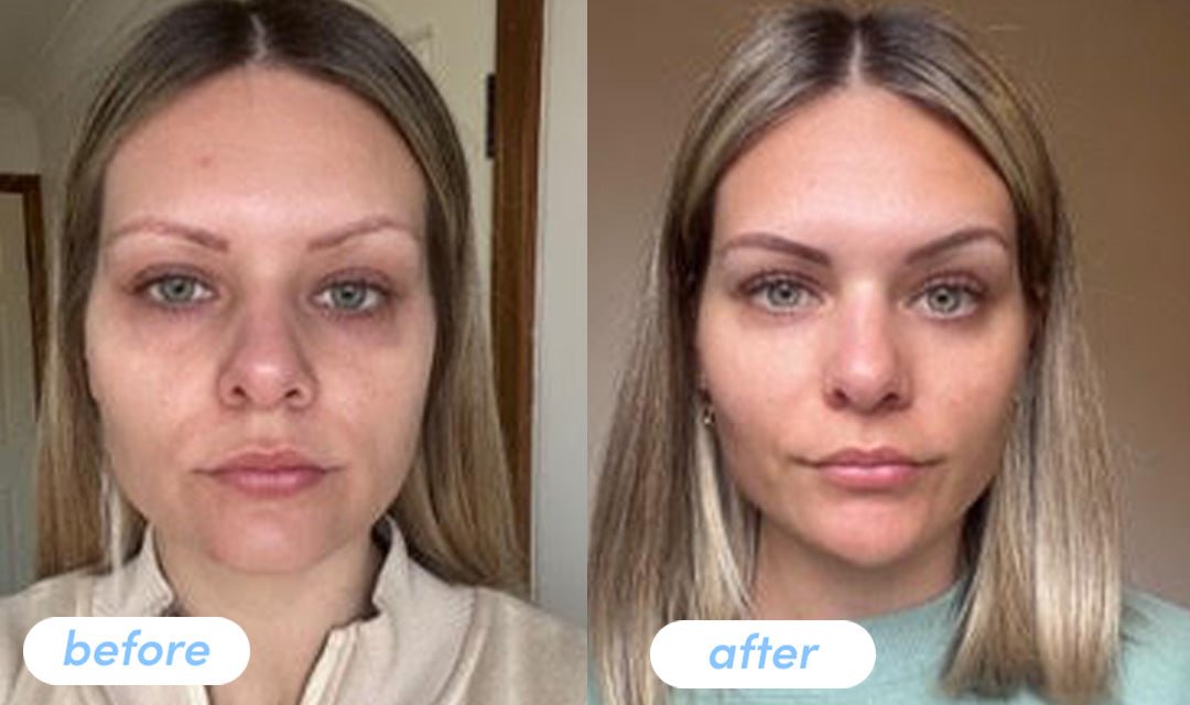 Amy J. - Taking Premium Collagen Peptides for 6 weeks - The Collagen Co.