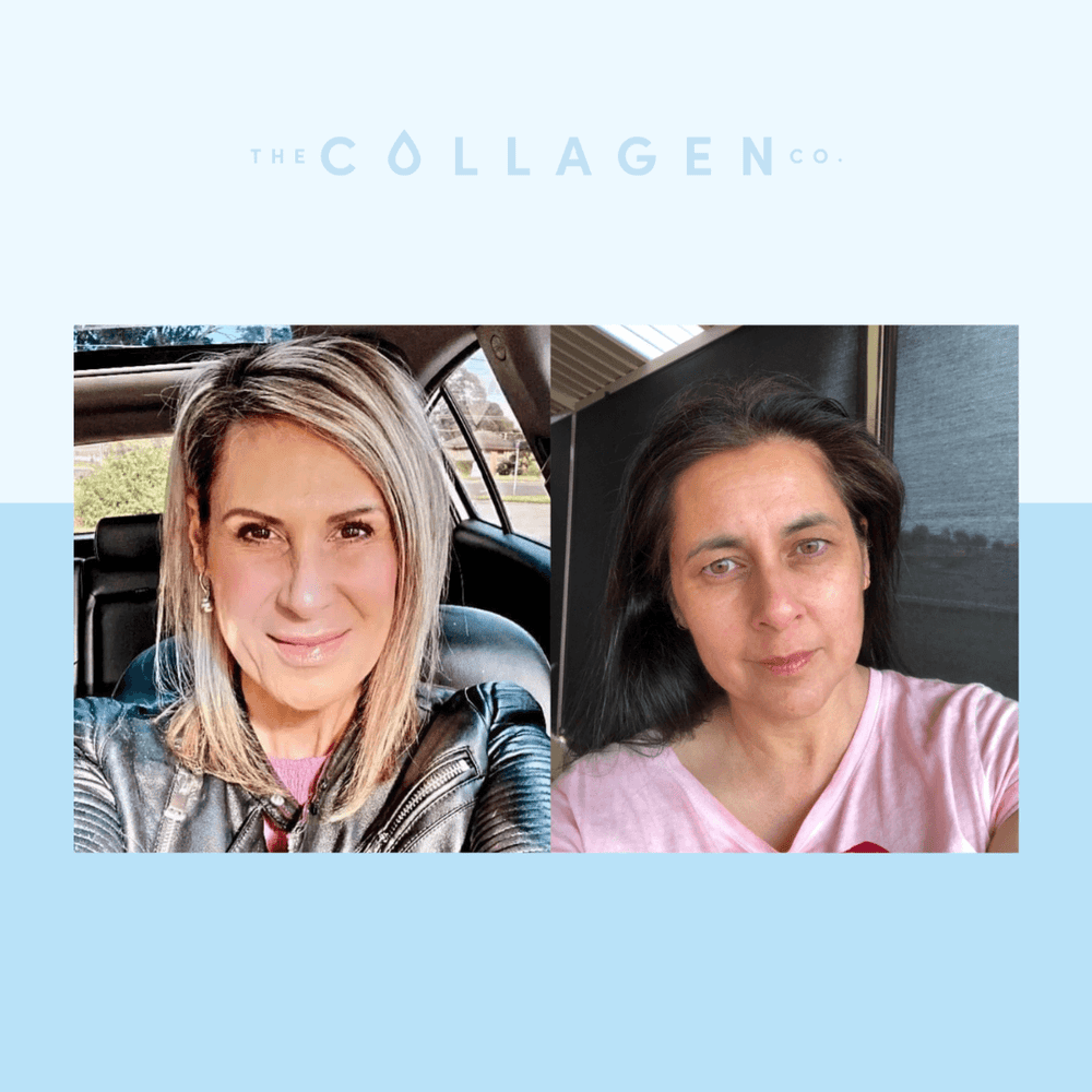 How Collagen Transformed Vanessa and Sandra's Skin and Hair