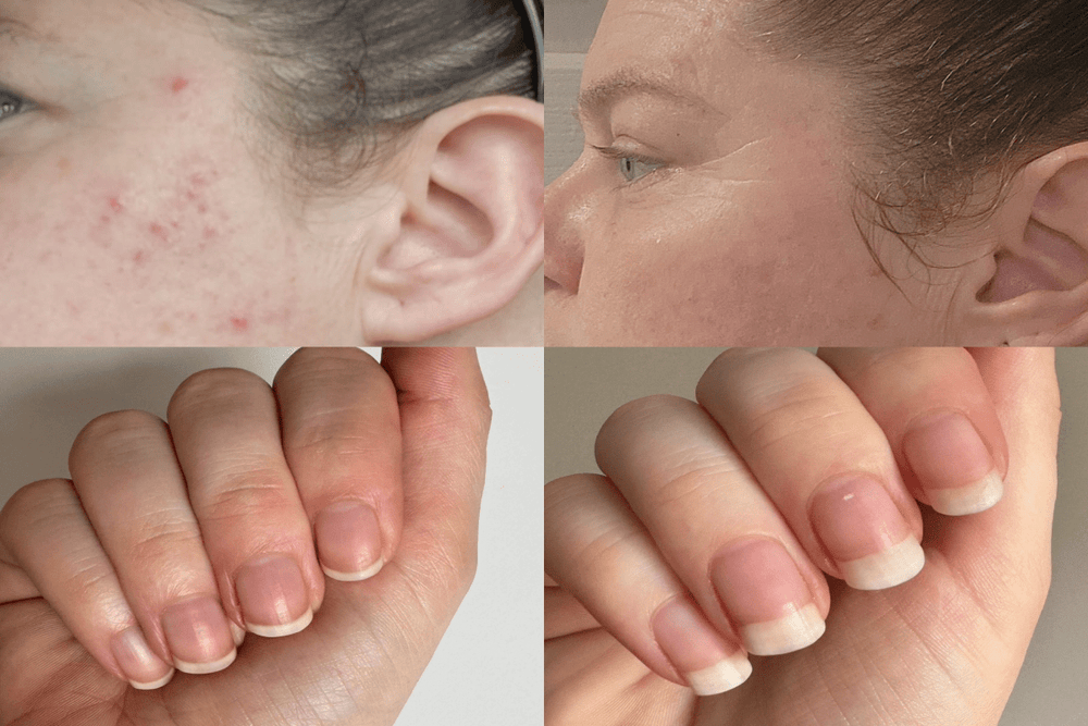 Taking Collagen at 30, 40, 50+ : It’s Never Too Early, or Too Late, to Start