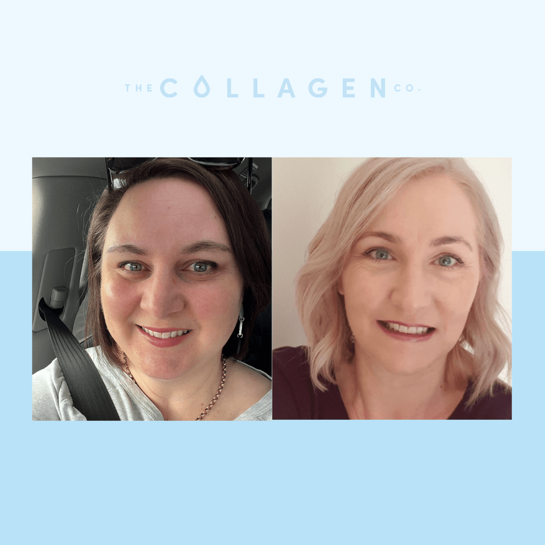 Two Mums On How Collagen Helps Their Skin and Gut Health - The Collagen Co.