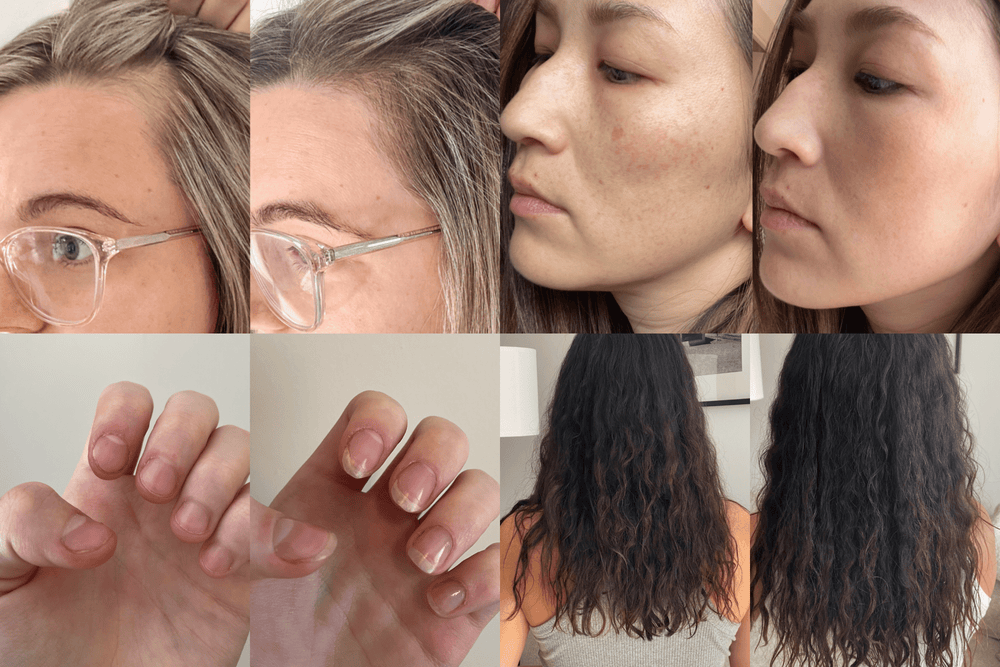 What to Expect before and after Collagen (4 Results Backed with Customer Photos)
