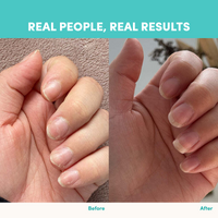 Side-by-side comparison of fingernails before and after using The Collagen Co. Unflavored Beauty Marine Collagen Powder—before nails are chipped and damaged; after, they look healthier, longer, and smoother. Text: Real People, Real Results.