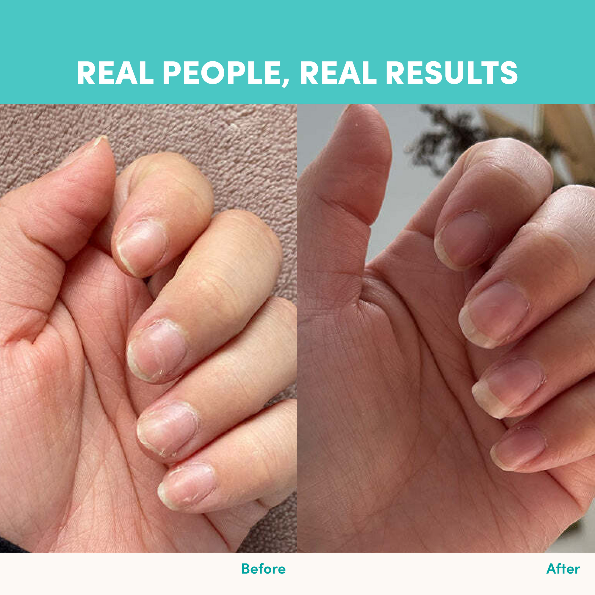 Side-by-side comparison of fingernails before and after using The Collagen Co. Unflavored Beauty Marine Collagen Powder—before nails are chipped and damaged; after, they look healthier, longer, and smoother. Text: Real People, Real Results.