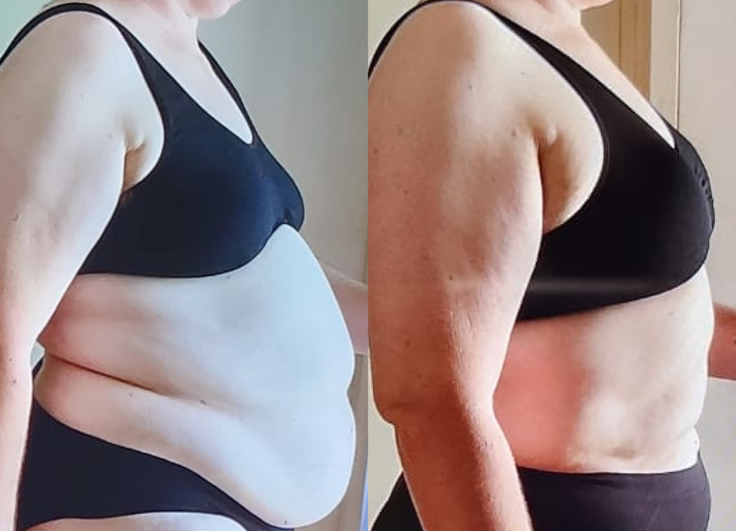 Side-by-side photos show a person in a black bra and underwear before and after weight loss, highlighting a noticeable reduction in belly size and more defined body contours.