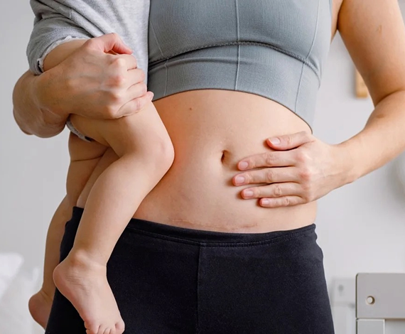 A person wearing a sports bra and black pants holds a small child on their hip. The person’s hand rests on their bare stomach, and the focus is on their midsection and the childs legs.