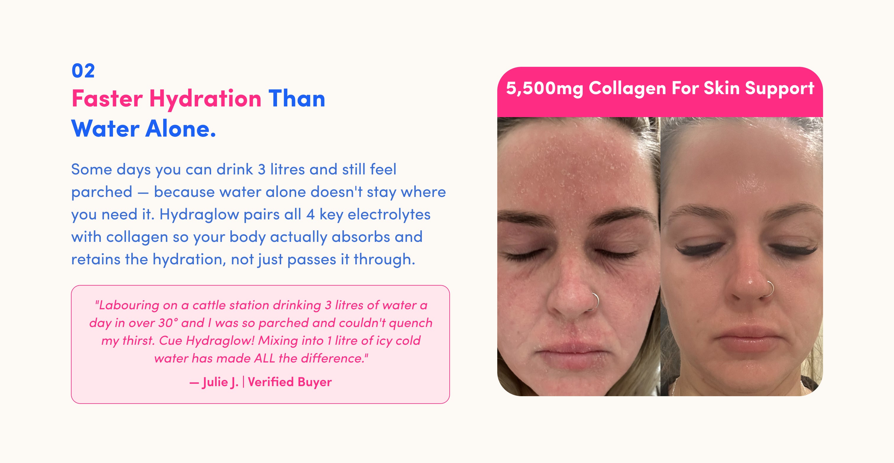 02 – Faster Hydration Than Water Alone." A side-by-side before-and-after photo shows a woman with her eyes closed. In the left image, her skin appears red, dry, and flaky; in the right image, her complexion looks smoother and more hydrated. A pink banner across the images reads, "5,500mg Collagen For Skin Support." Below, text explains that Hydraglow combines four key electrolytes with collagen to help the body absorb and retain hydration more effectively than water alone. 