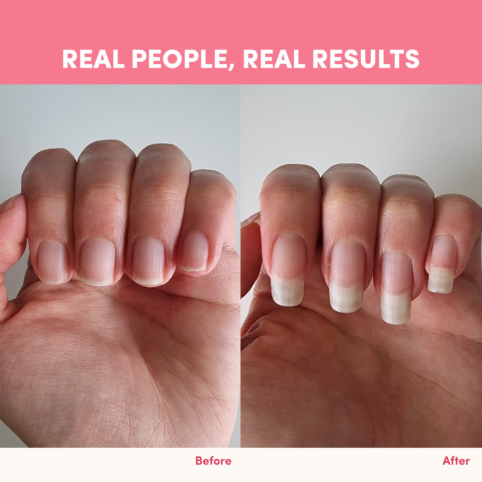 Side-by-side comparison of fingernails before and after using Strawberry Watermelon Collagen Powder - 560g by thecollagen.co; left shows short nails, right shows longer, healthier nails. Text reads Real People, Real Results.