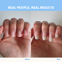 Side-by-side comparison of a hand before and after using thecollagen.co Unflavored Collagen Powder - 420g. Left: short nails; right: noticeably longer, healthier nails. Text above: Real People, Real Results. Before and After labels below.