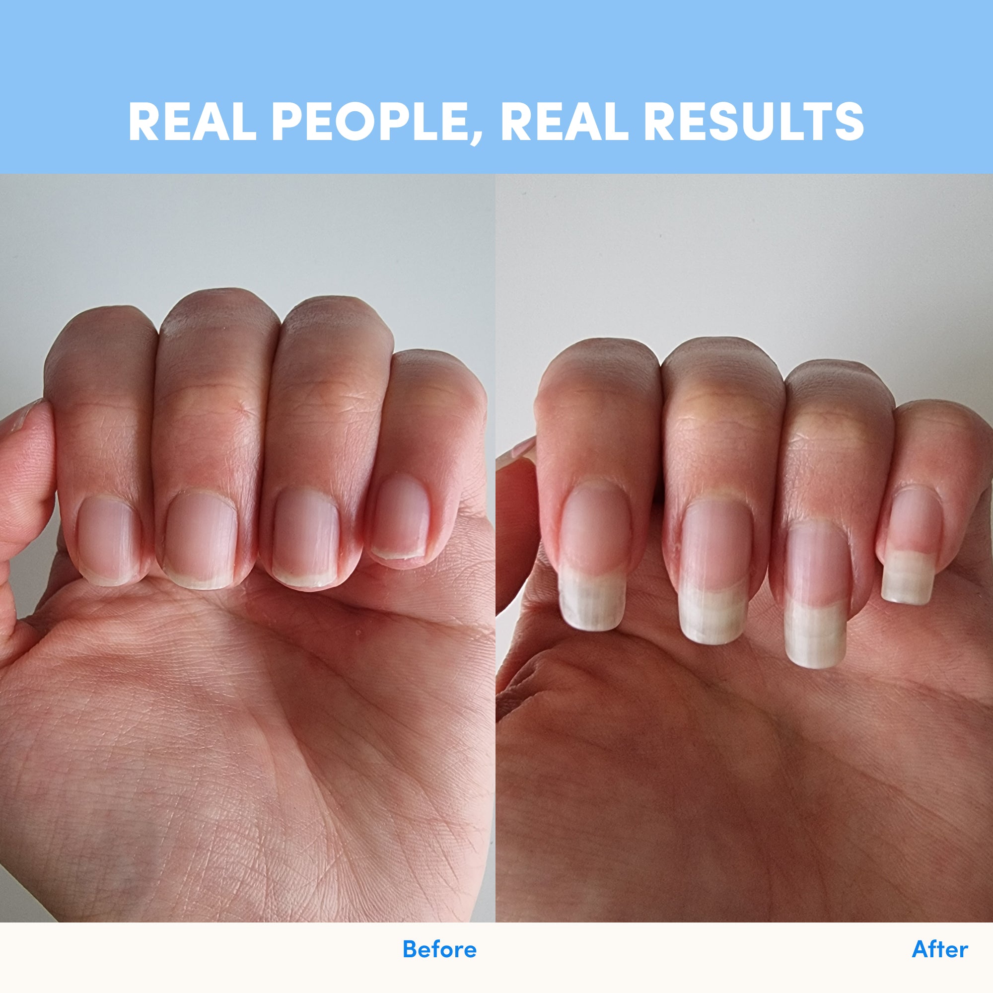 Side-by-side comparison of a hand before and after using thecollagen.co Unflavored Collagen Powder - 420g. Left: short nails; right: noticeably longer, healthier nails. Text above: Real People, Real Results. Before and After labels below.