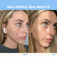 Side-by-side photos show a woman’s face before and after using thecollagen.co Unflavored Collagen Sachets - 210g. “REAL PEOPLE, REAL RESULTS” highlights the visible benefits for hair, skin, and nails with hydrolysed bovine collagen.