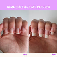 A side-by-side shows fingernails before and after: shorter nails on the left, longer, healthier nails on the right. Text above reads “REAL PEOPLE, REAL RESULTS.” Powered by The Collagen Co. Mixed Berry Collagen Sachets - 280g.
