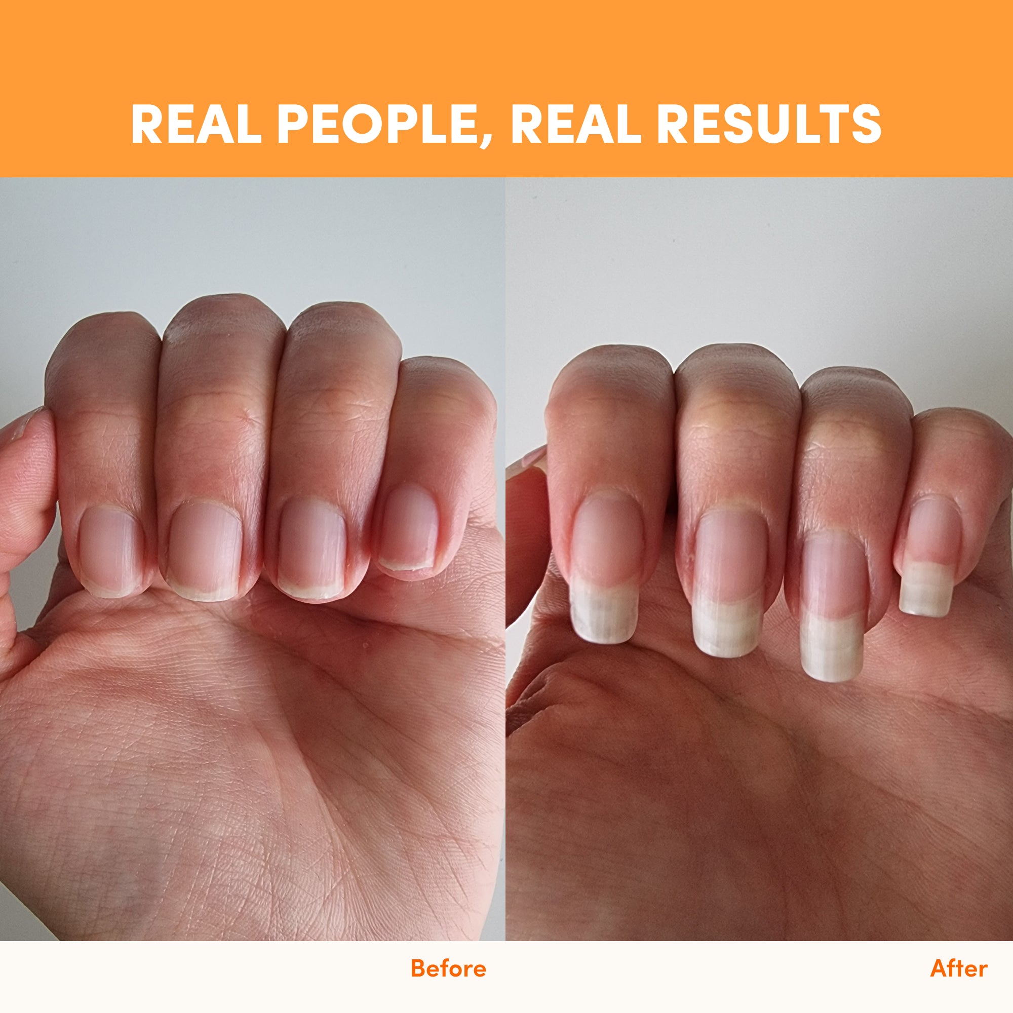A side-by-side view of fingernails before and after growth showcases the benefits of thecollagen.co’s Passionfruit Mango Collagen Sachets - 280g for beauty and wellness. Text at top: REAL PEOPLE, REAL RESULTS.