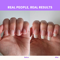 A hand appears in side-by-side photos: left shows short nails, right shows longer nails—thanks to The Collagen Co USA Purple Grape Collagen Sachets - 280g. Text above reads REAL PEOPLE, REAL RESULTS; below are labels Before and After.