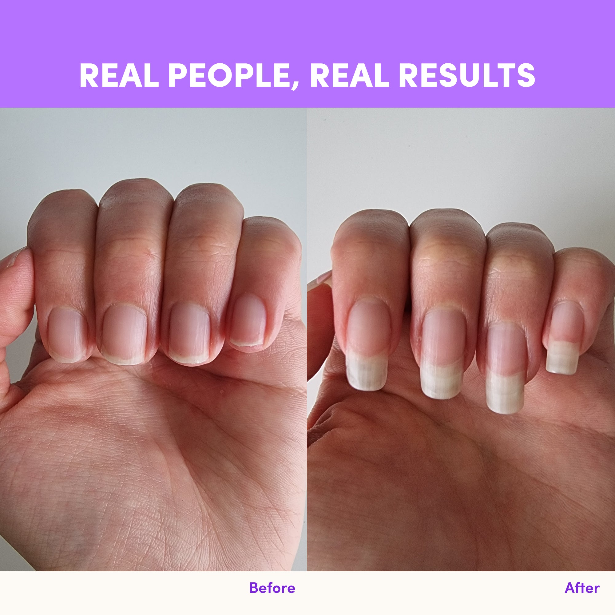 A hand appears in side-by-side photos: left shows short nails, right shows longer nails—thanks to The Collagen Co USA Purple Grape Collagen Sachets - 280g. Text above reads REAL PEOPLE, REAL RESULTS; below are labels Before and After.