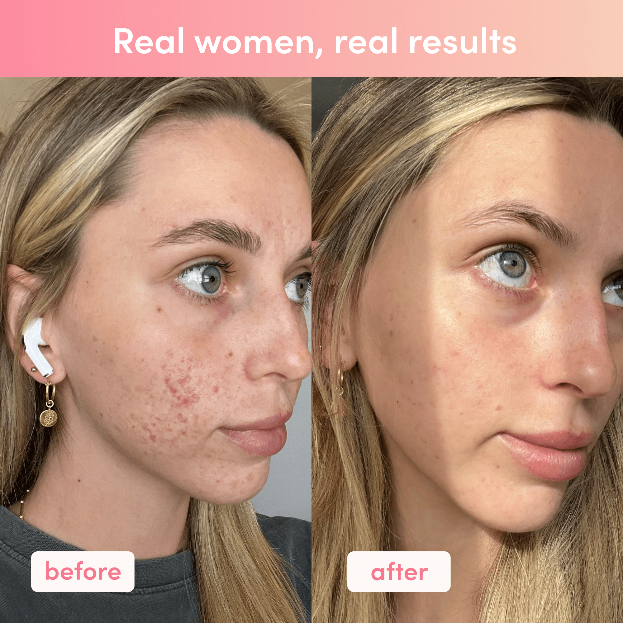 light up with glutathione and collagen Ultimate Glow Up Bundle light up with glutathione and collagen Ultimate Glow Up Bundle